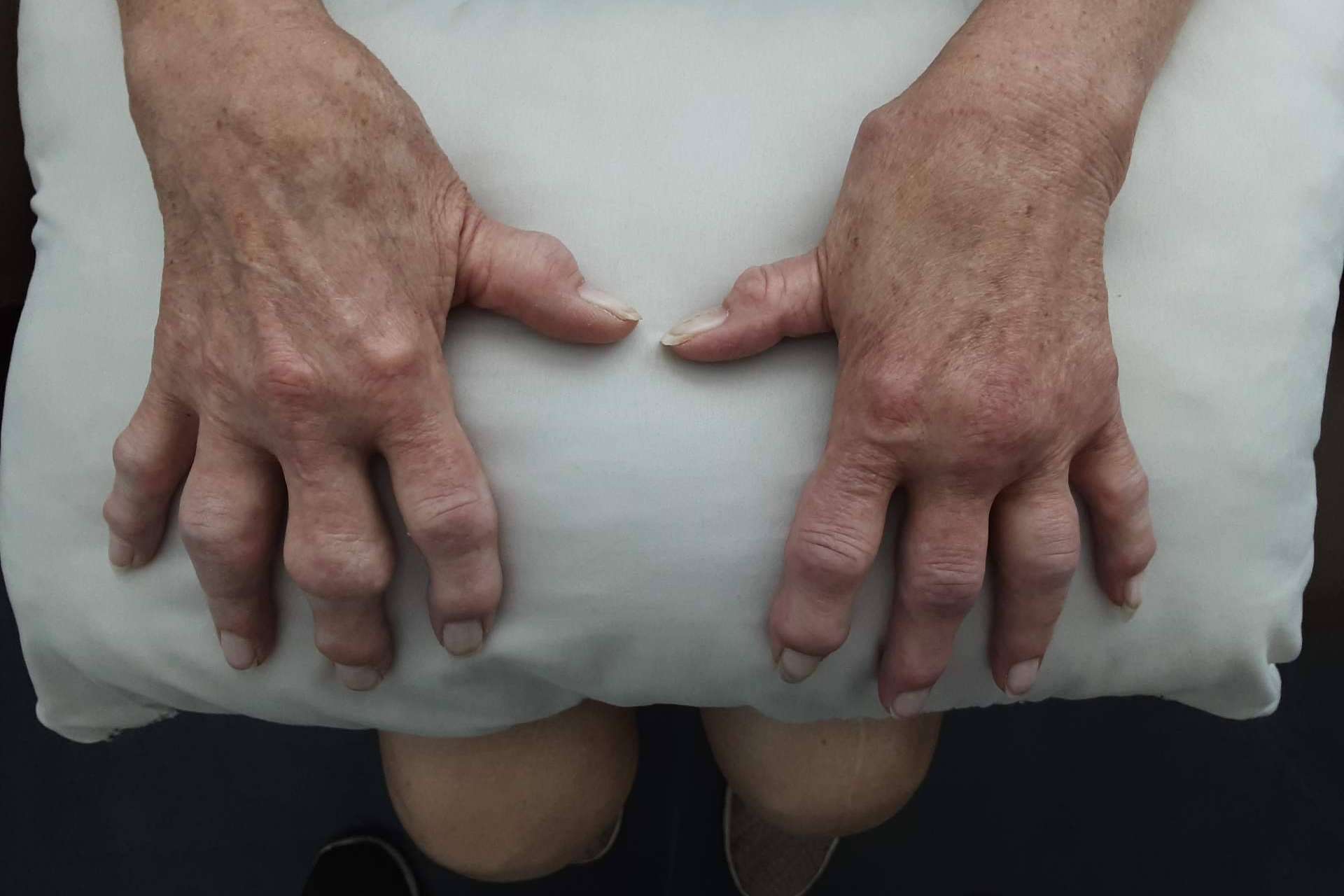 ¿Dónde encontrar una clínica especializada en medicina regenerativa? Immunotherapy Regenerative Medicine