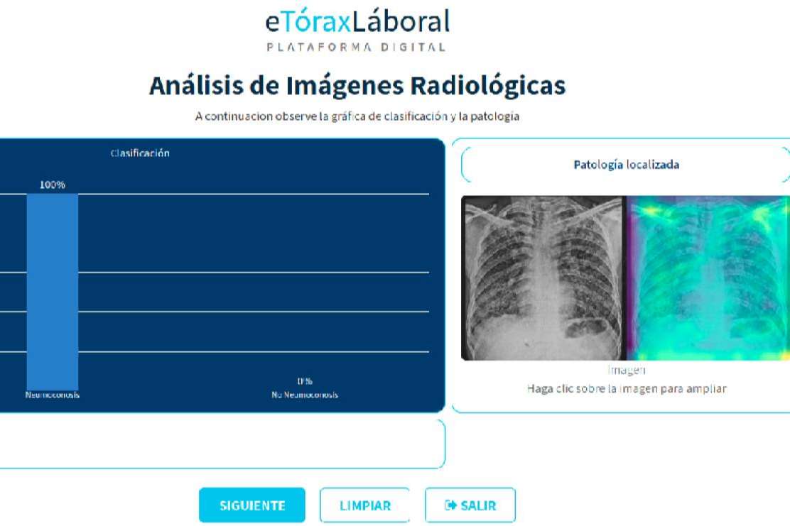 eTóraxLaboral, una herramienta pionera para la detección temprana de neumoconiosis